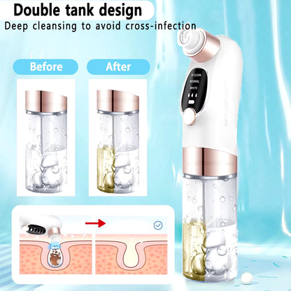 Blackhead Remover Pore Vacuum Face Cleaner Electric Pimple Acne Black Head Removal USB Rechargeable Water Cycle Black Dot Remove