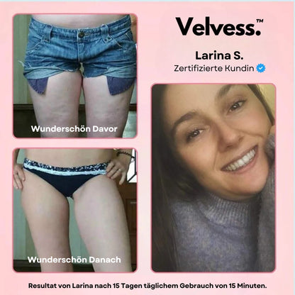 Velvess™ - Cellulite Massage Gerät